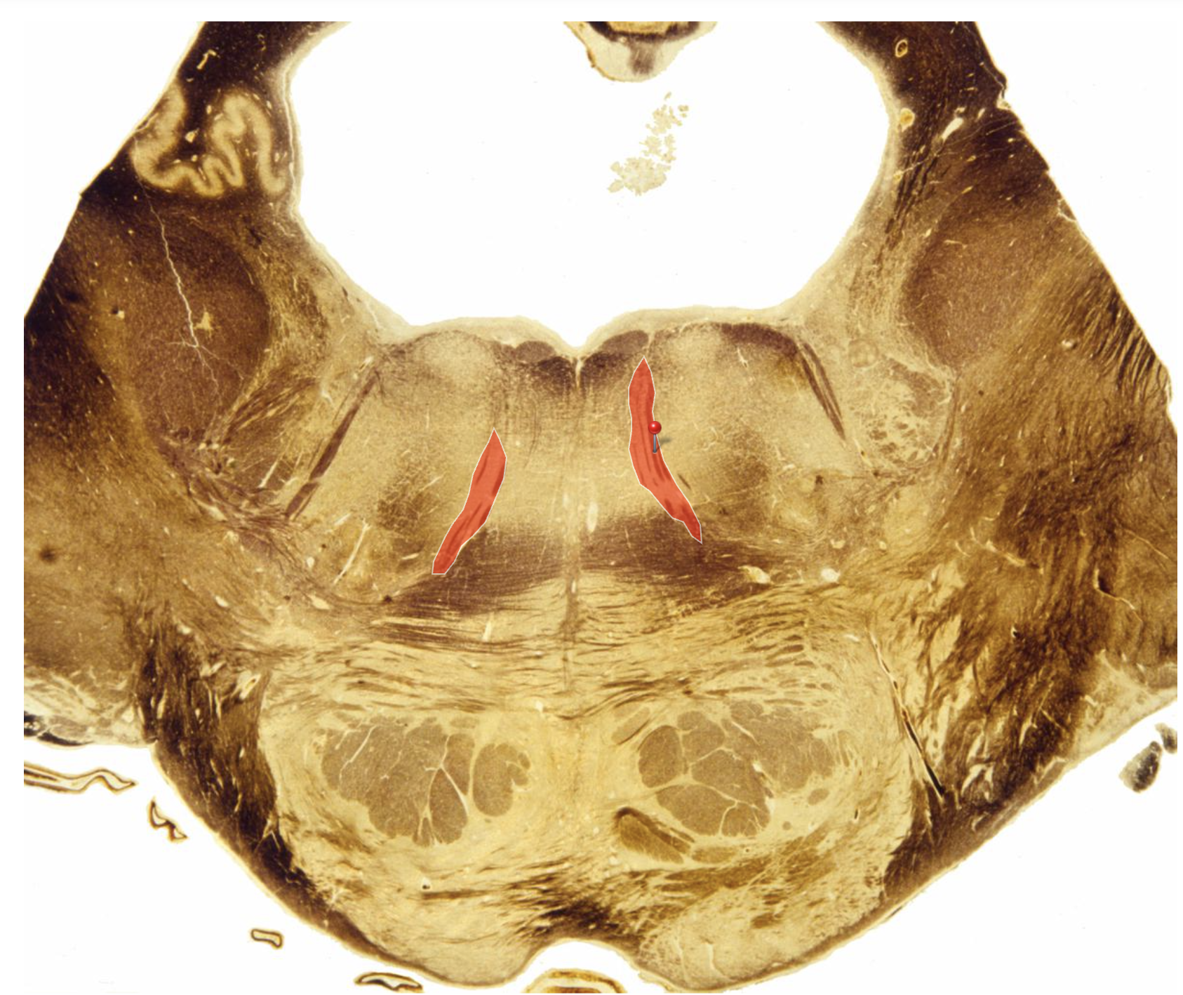 <p>Identify</p>
