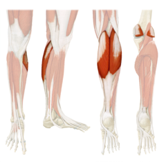 <p>Anterior calf muscle that straightens the foot, the more superior calf muscle, origin at posterior femur, insert at calcaneus (tarsal) through Achilles tendon</p>
