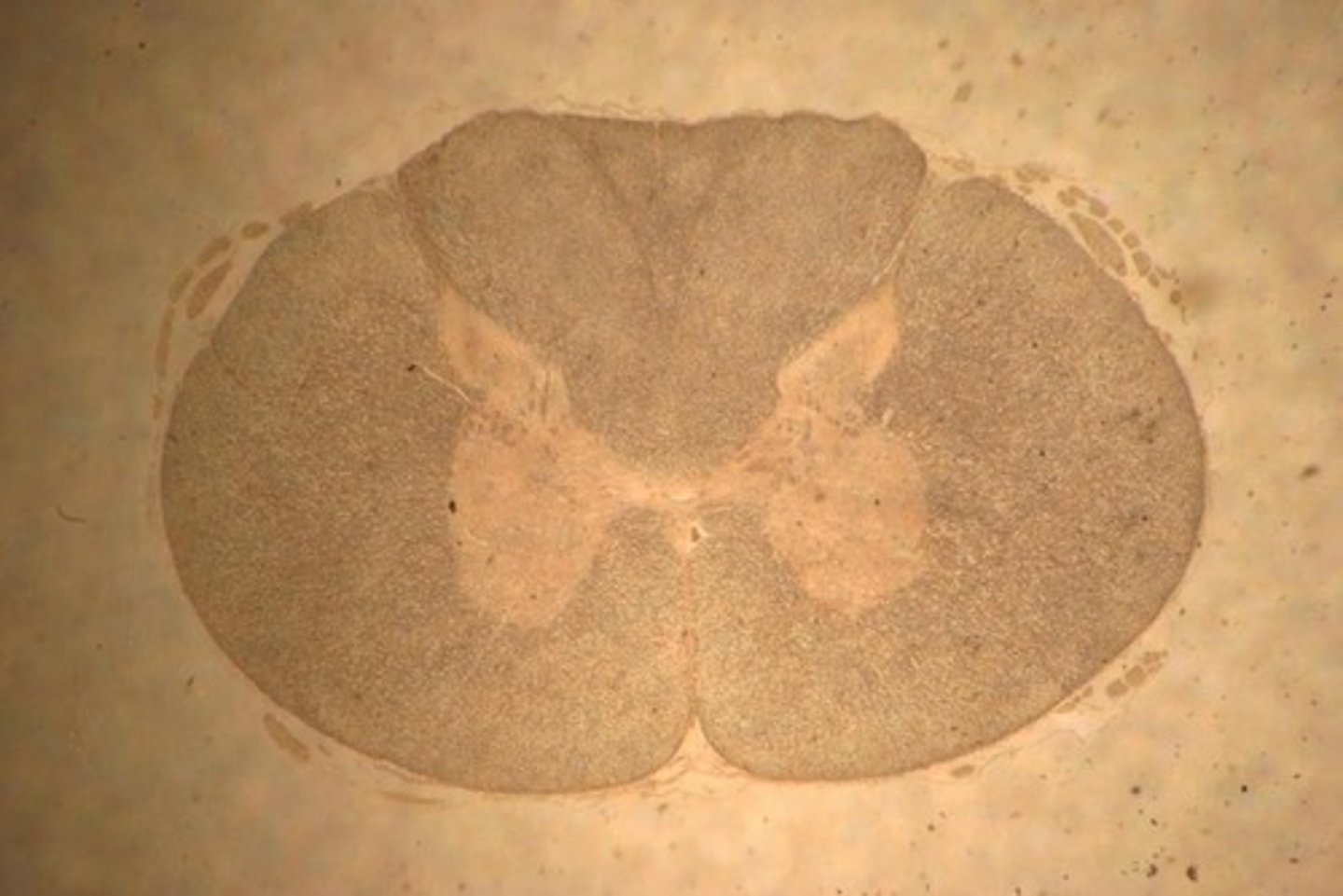 <p>The spinal cord has grey matter on the inside and white matter on the outside, with ascending and descending pathways connecting the brain and body.</p>