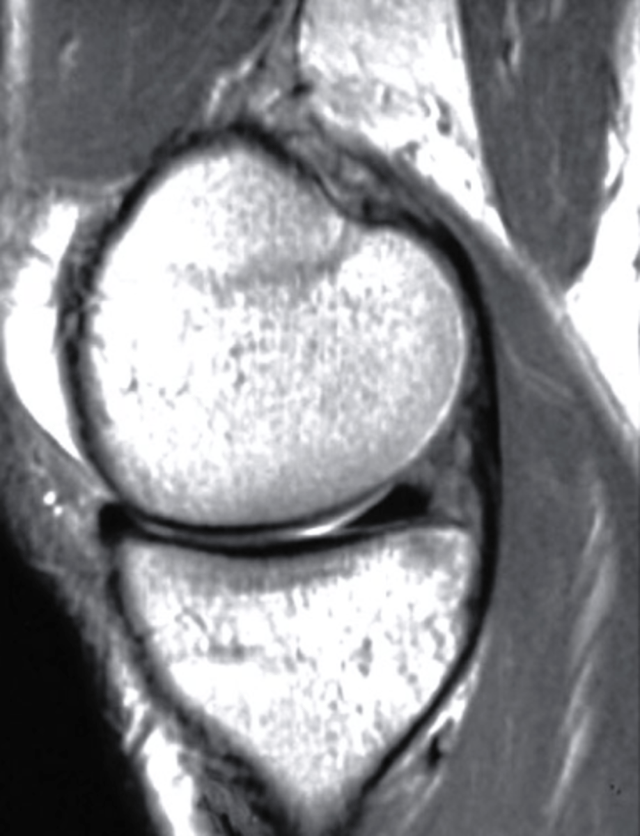 <p>what is the view of this image?</p><p>a. coronal</p><p>b. axial</p><p>c. frontal</p><p>d. sagittal</p>