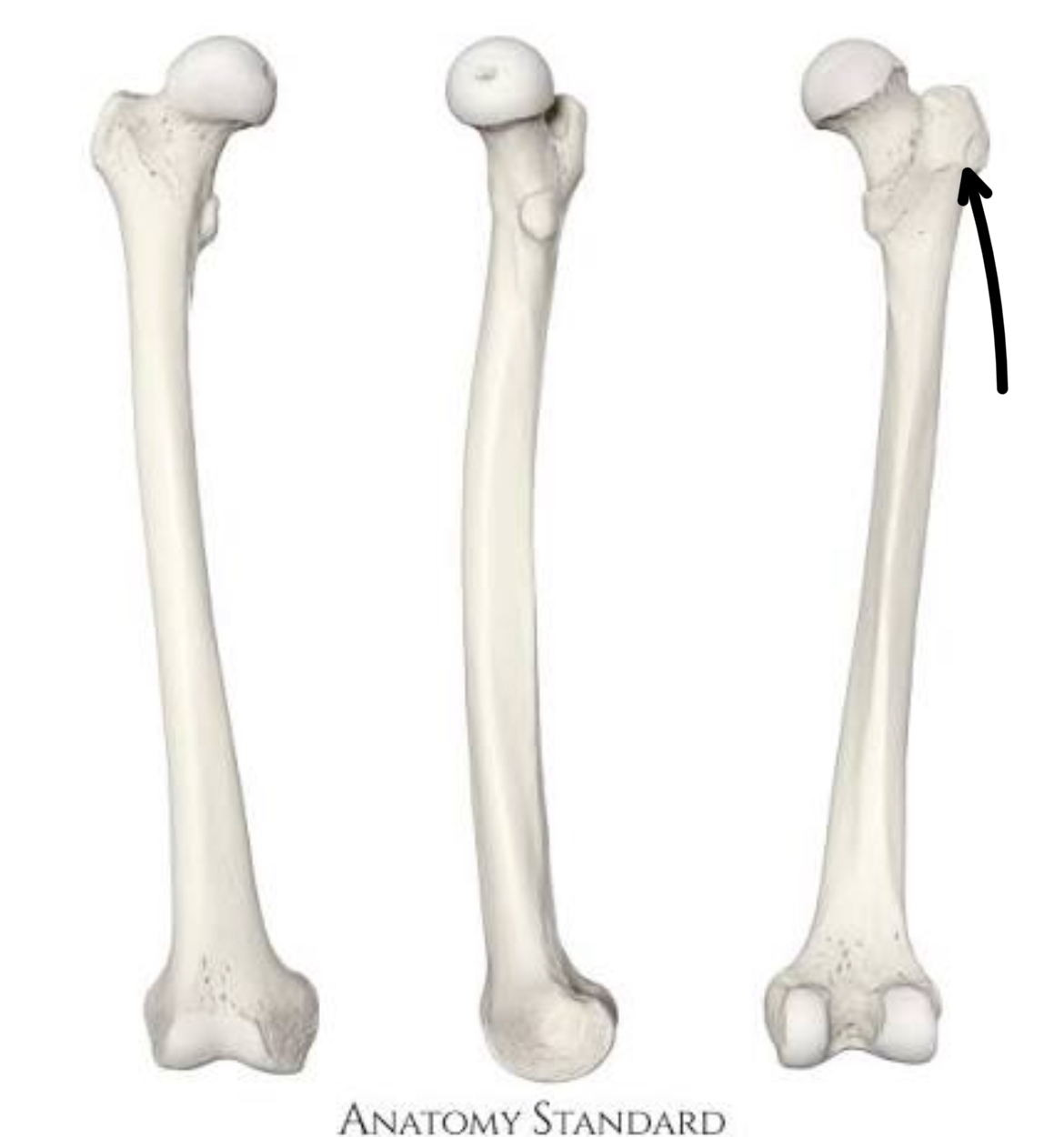 <p>what part of the femur is this?</p>