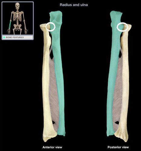 <p>- proximal end (stump) of radius </p><p>- proximal end of ulna on its lateral side (closest to radius)</p>