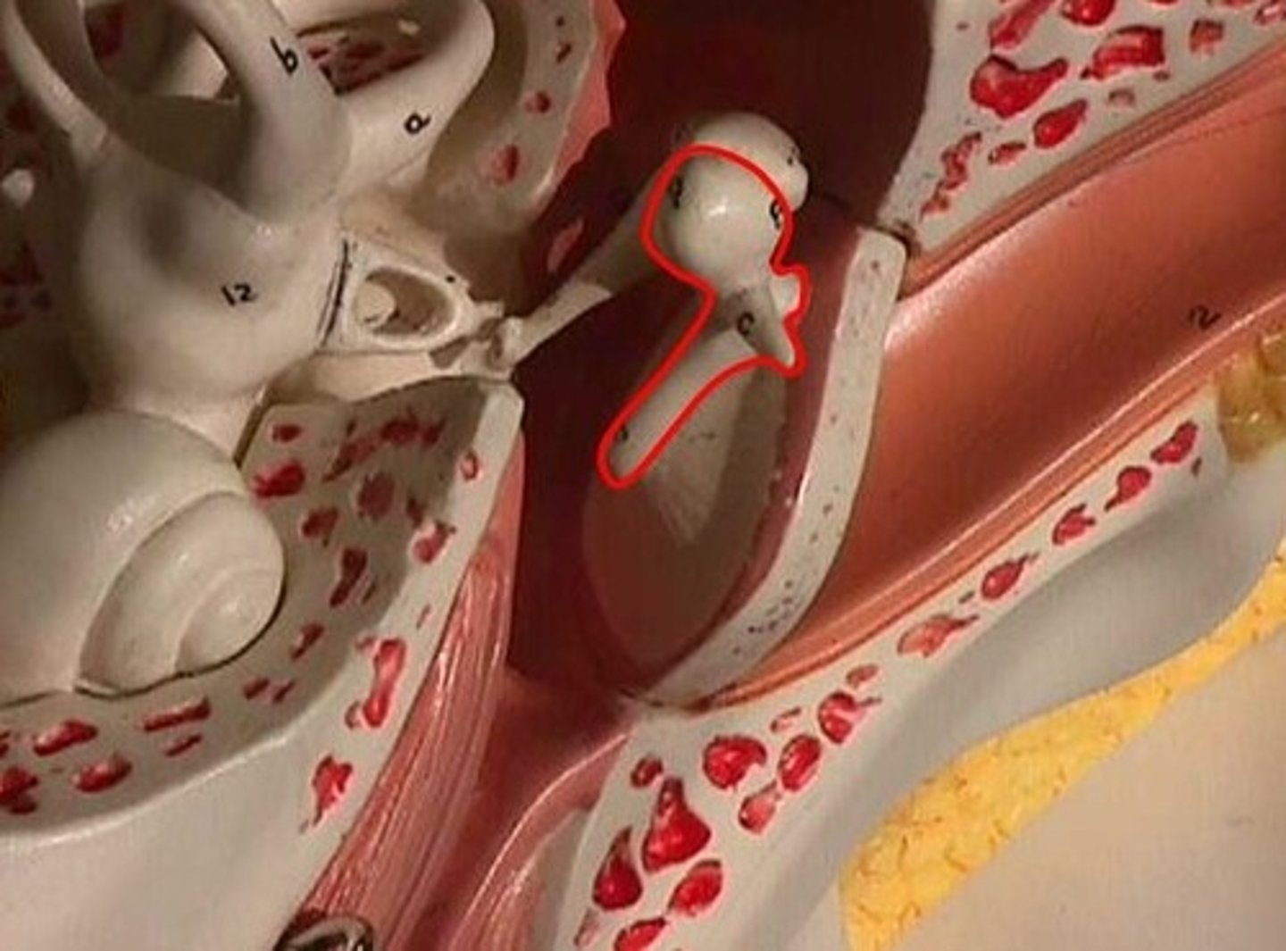 <p>hammer; first of the three auditory ossicles of the middle ear</p>