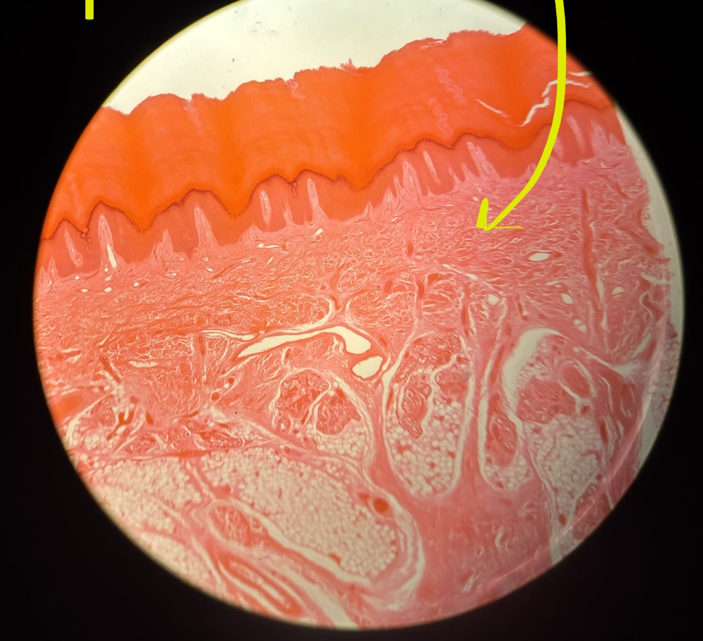term image