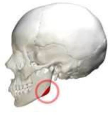 <p>Which mandibular marking is this? (2)</p>