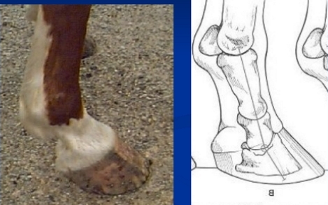 <p><span style="background-color: transparent;"><strong><span>Heel Abnormality's </span></strong></span></p>