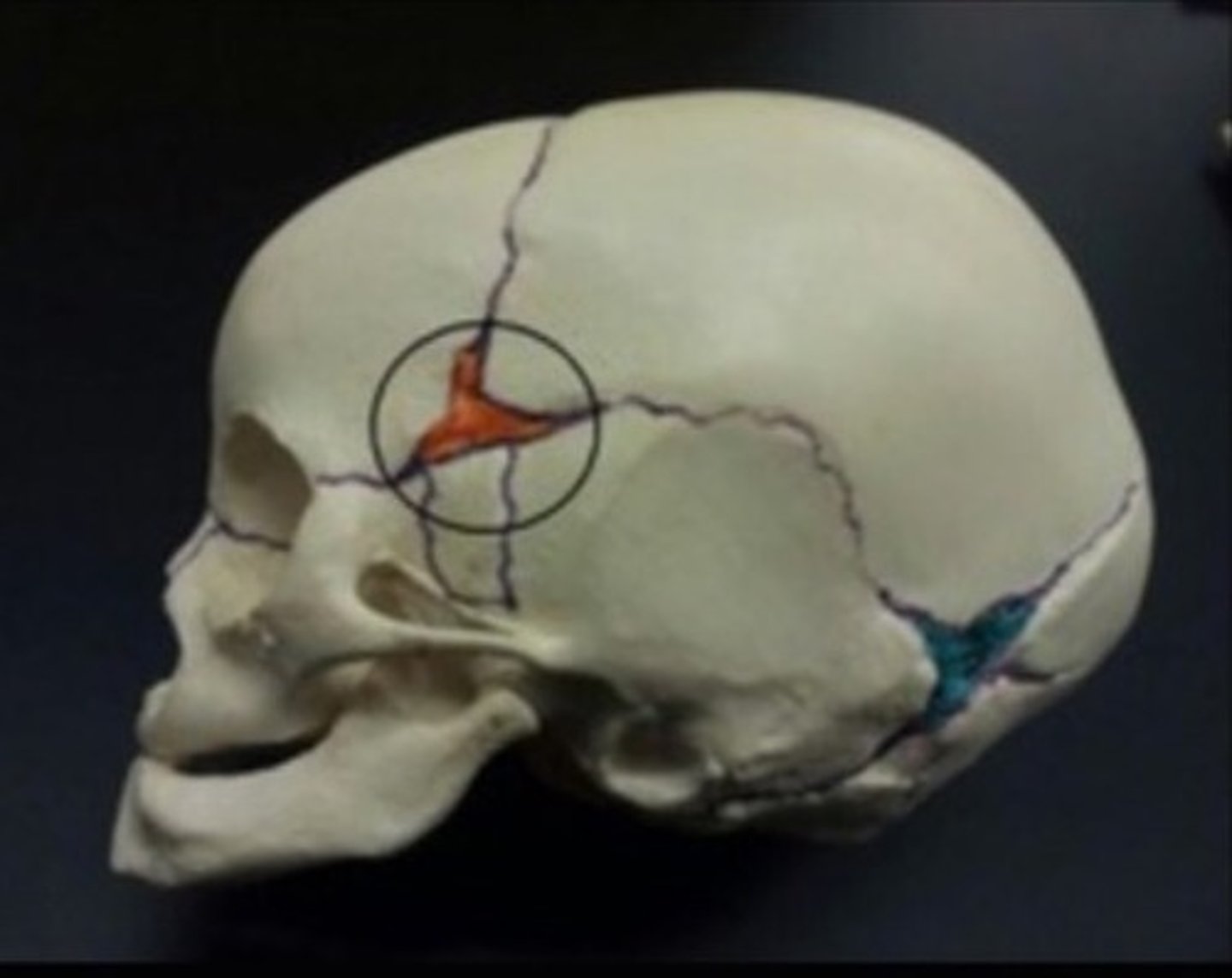 <p>junction</p><p>around the temple of the head</p><p>on both sides of the skull</p>