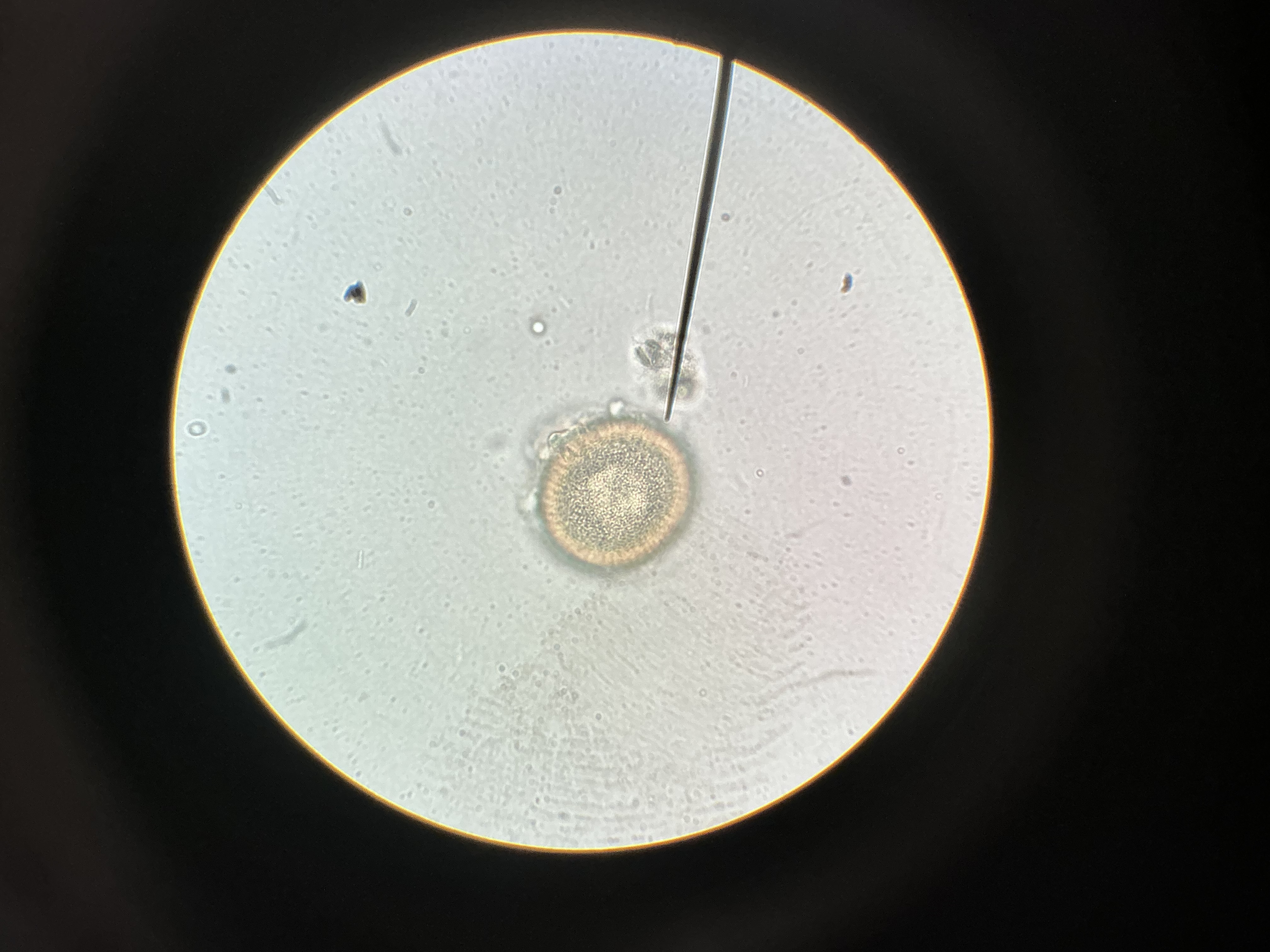 <p>Taenia allium</p>