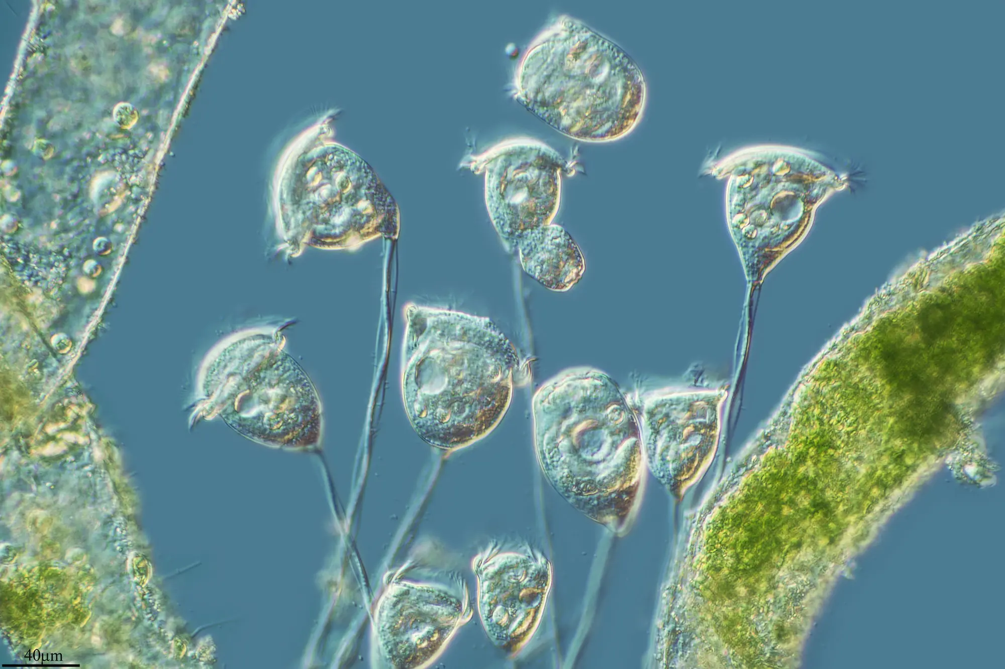 <p>Vorticella</p>