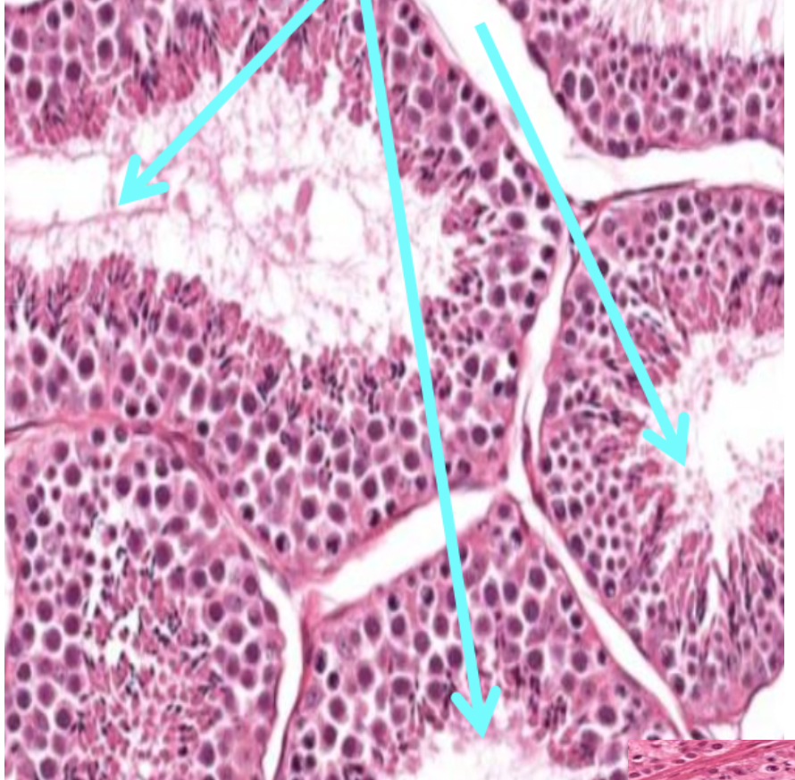 <p>What does the arrows in this image show?</p>