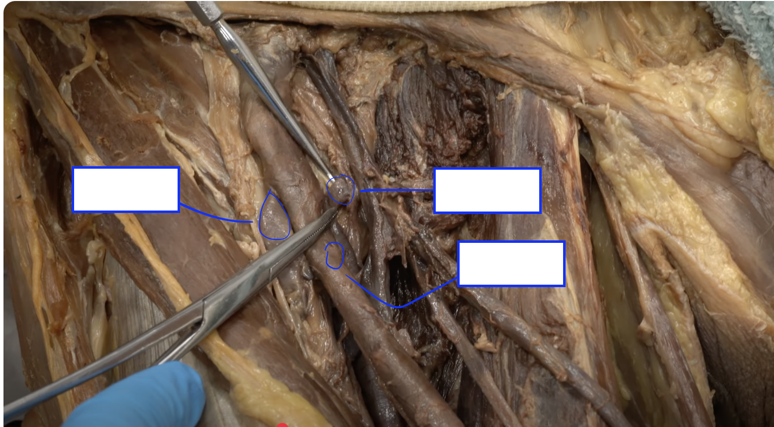 <p>bottom right </p>
