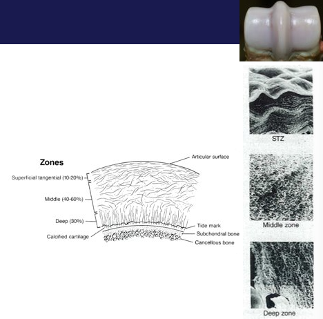 <ol><li><p>3D latticework of type 2 collagen fibres, orientation of fibres is divided into zones, deeper (interface with bone) layer calcifies</p></li><li><p>Hydrated gel (chondrocytes, no blood vessels, lymphatics or nerves, deeper portion calcifies)</p></li></ol><ul><li><p>fills (expands) space b/w collagen fibres</p></li><li><p>held together by other ‘structural’ molecules such as collagen XI, collagen IX, fibromodulin, decorin, COMP.</p></li></ul><p></p>