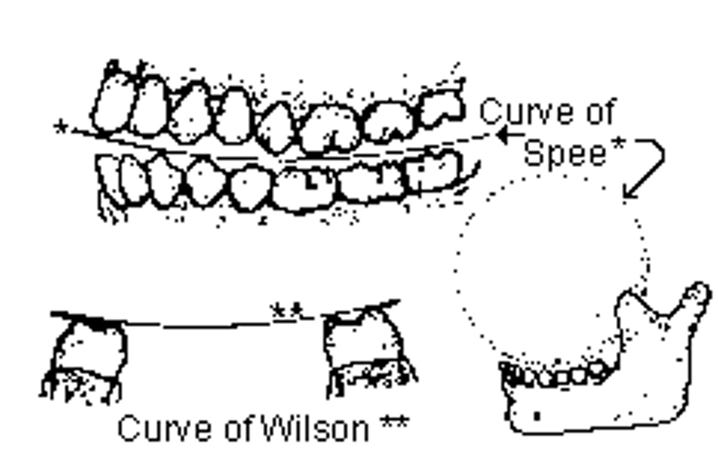 <p>Sagittal ocklusionskurva</p><p>- En linje från hörntänderna incisalt till kusparna buckalt på kinständerna</p><p>- Konvex kurva längst med ök och kontav i uk</p>