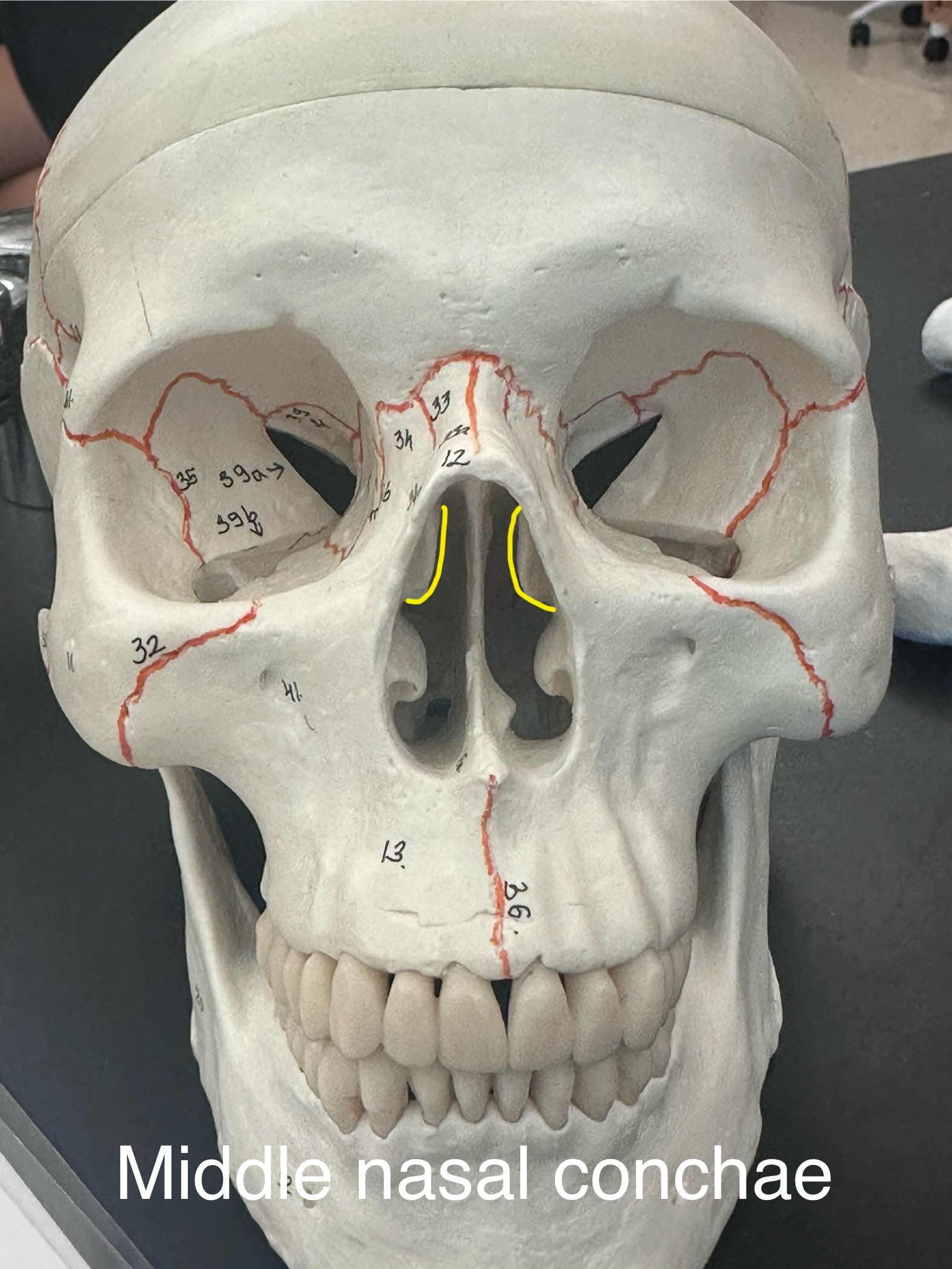 <p>Middle Nasal Conchae</p>