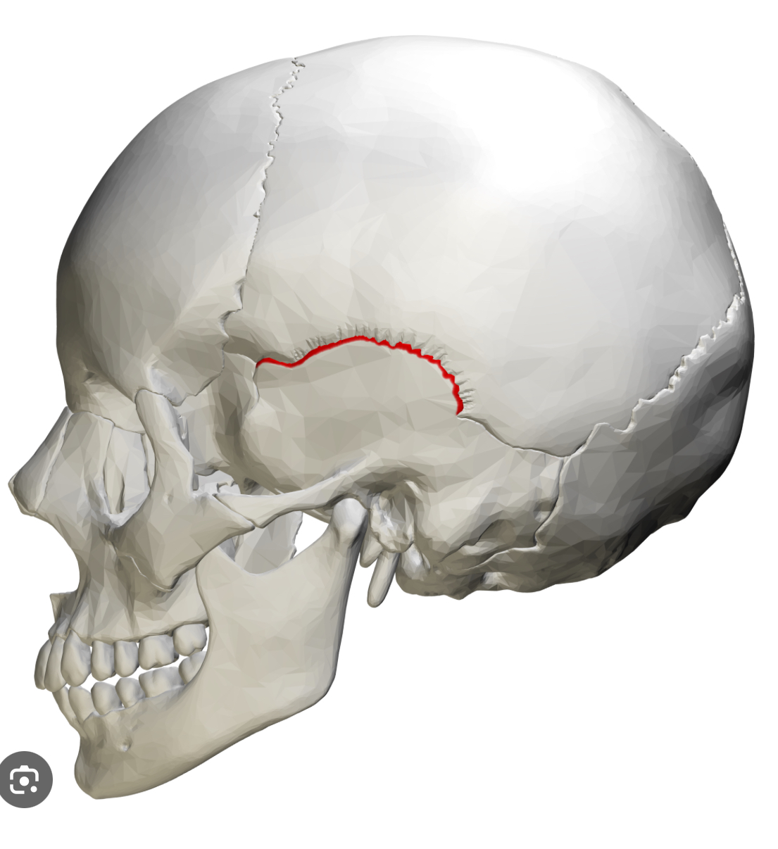 <p>Squamous suture</p>