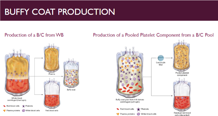 <ul><li><p><span>produces pool of plts from 4-6 whole blood donations</span></p><ul><li><p><span>Whole blood subjected to hard spin</span></p></li><li><p><span>Second stage starts with pooling buffy coats with one plasma component or bag of platelet additive solution</span></p></li><li><p><span>Most common in Europe and Canada</span></p></li><li><p><u><span>One pooled B/C platelet is generally considered a normal adult dose</span></u></p></li></ul></li></ul><p></p>