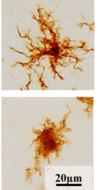 Ruhezustand (oben):
- Ständige Bewegung der Zellfortsätze, Überwachung

Aktivzustand (unten):
- amöboide (wechselnd) Form -> können sich schneller bewegen
- Phagozytose, Umbau von Synapsen & Zelltod nur im Aktivzustand