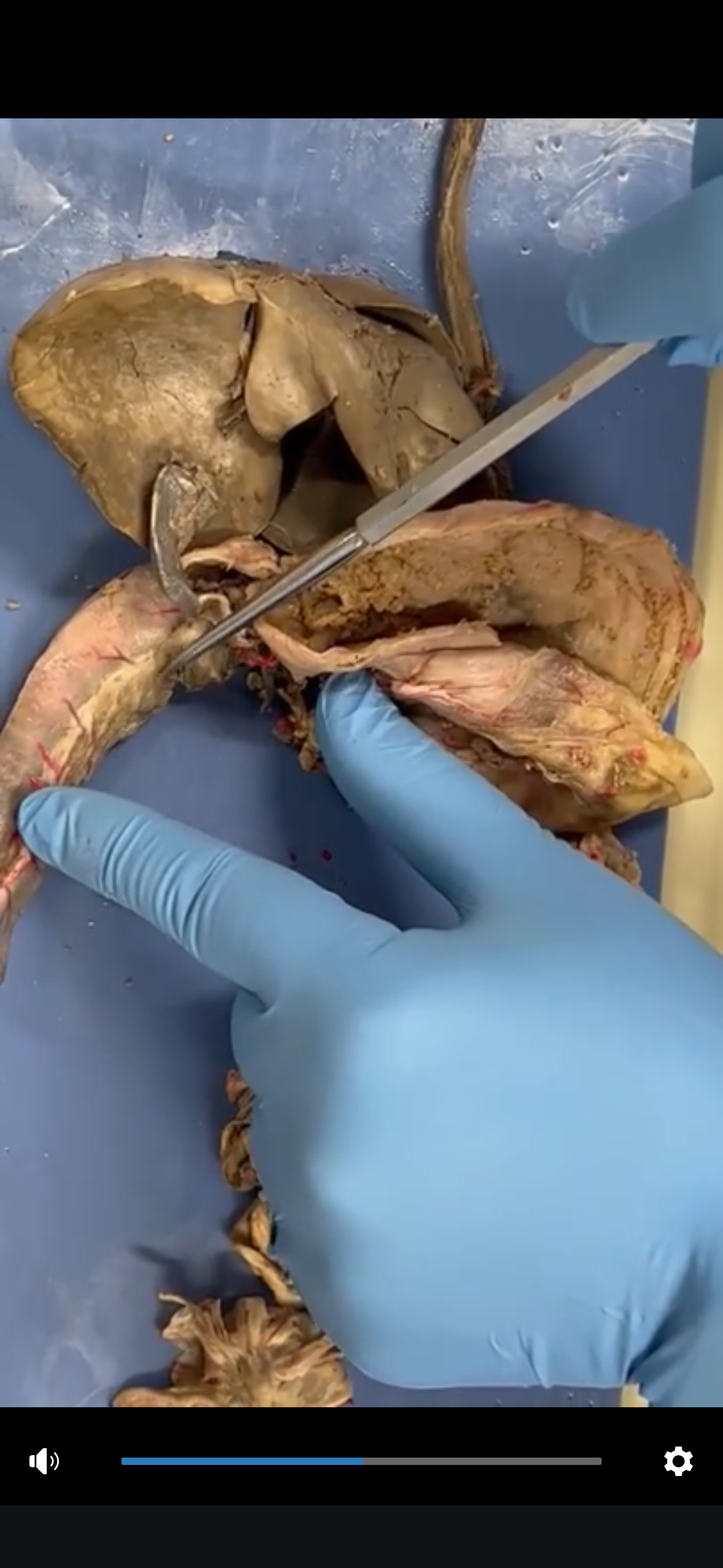 <p>Pancreas</p>