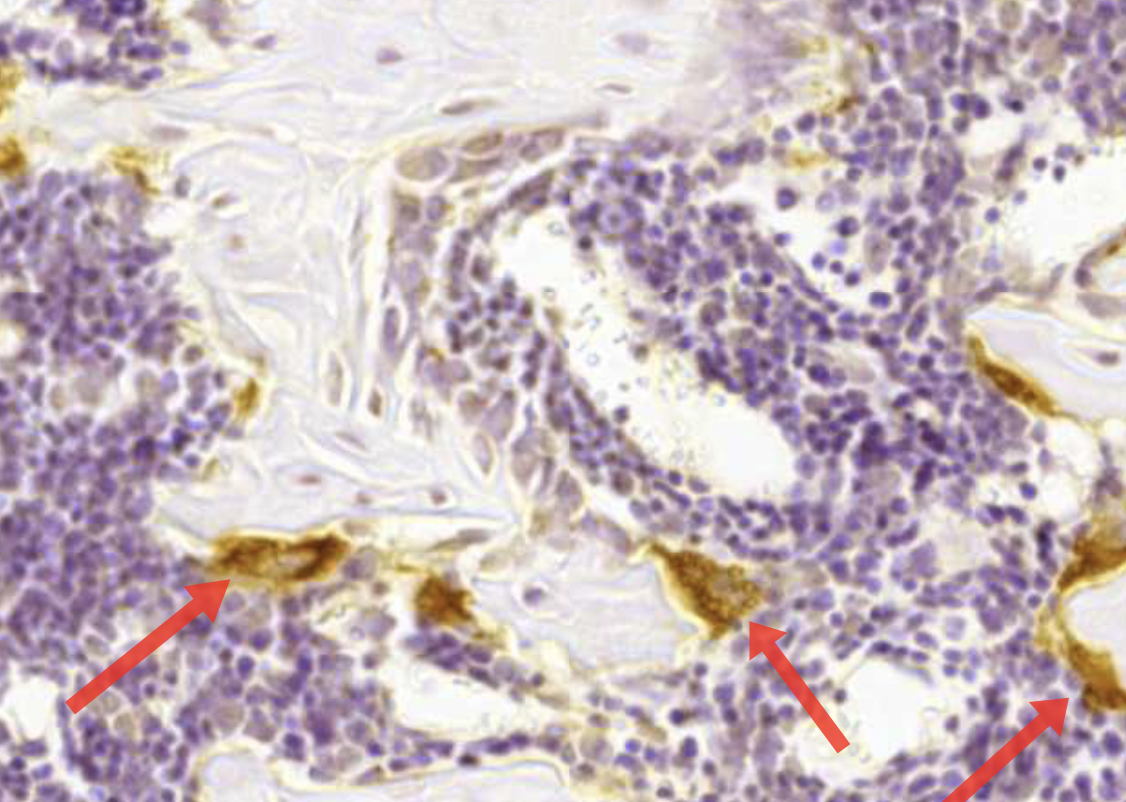 term image
