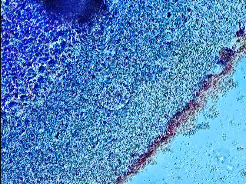 <p><span data-name="microscope" data-type="emoji">🔬</span><span data-name="petri_dish" data-type="emoji">🧫</span><strong><span> </span>Na podstawie zdjęcia preparatu:</strong></p><p></p><ul><li><p><span>📖 </span>rozpoznaj gatunek pasożyta;</p></li></ul><p></p><ul><li><p><span>♻ </span>rozpoznaj wszystkie formy rozwojowe;</p></li></ul><p></p><ul><li><p><span>🦠 </span>wskaż organelle i cechy charakterystyczne dla danego gatunku;</p></li></ul><p></p><ul><li><p><span>😷 </span>nazwij chorobę, którą pasożyt wywołuje.</p></li></ul><p></p>