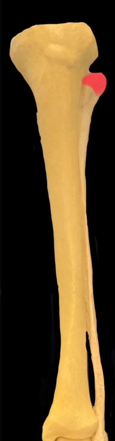 What is highlighted in red?

What muscle attaches here?

What passive structure attaches here?