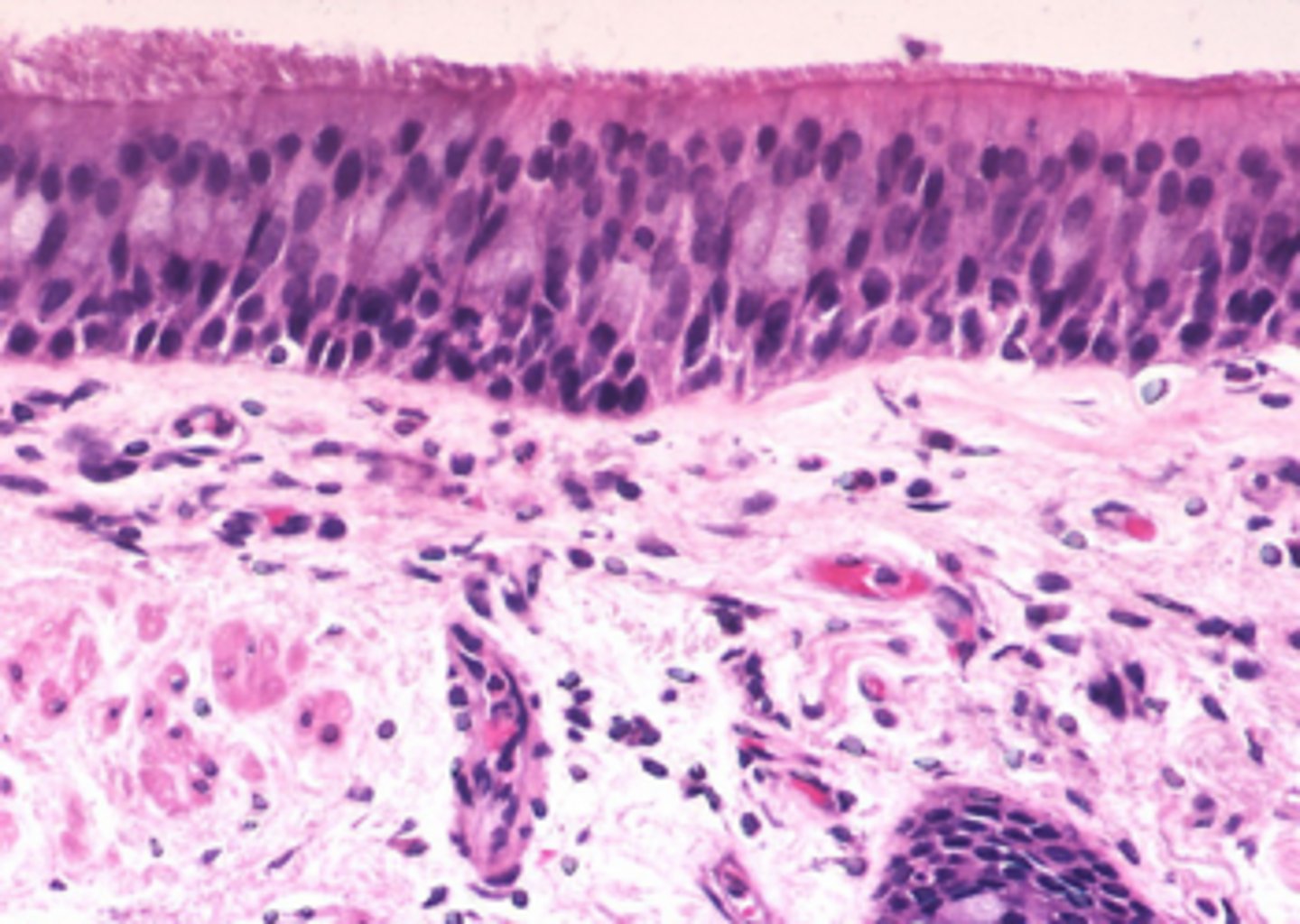 <p>mucus-covered membrane that lines the tubes of the respiratory tract.</p>