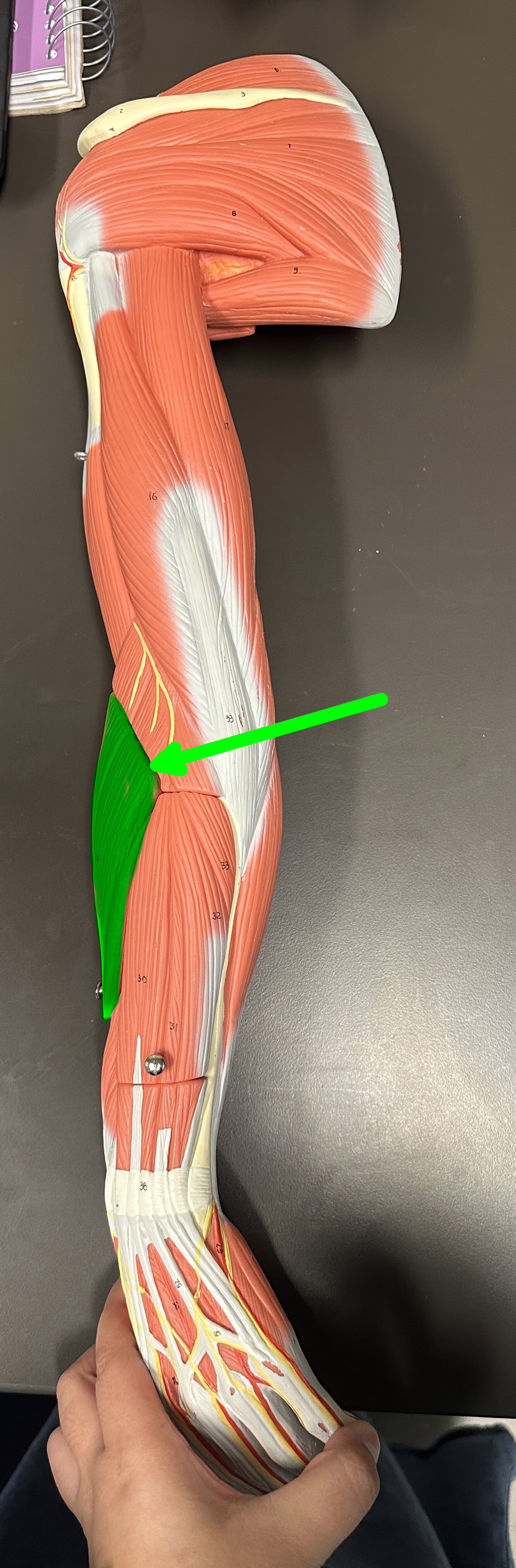 <p>What is the highlighted structure</p>