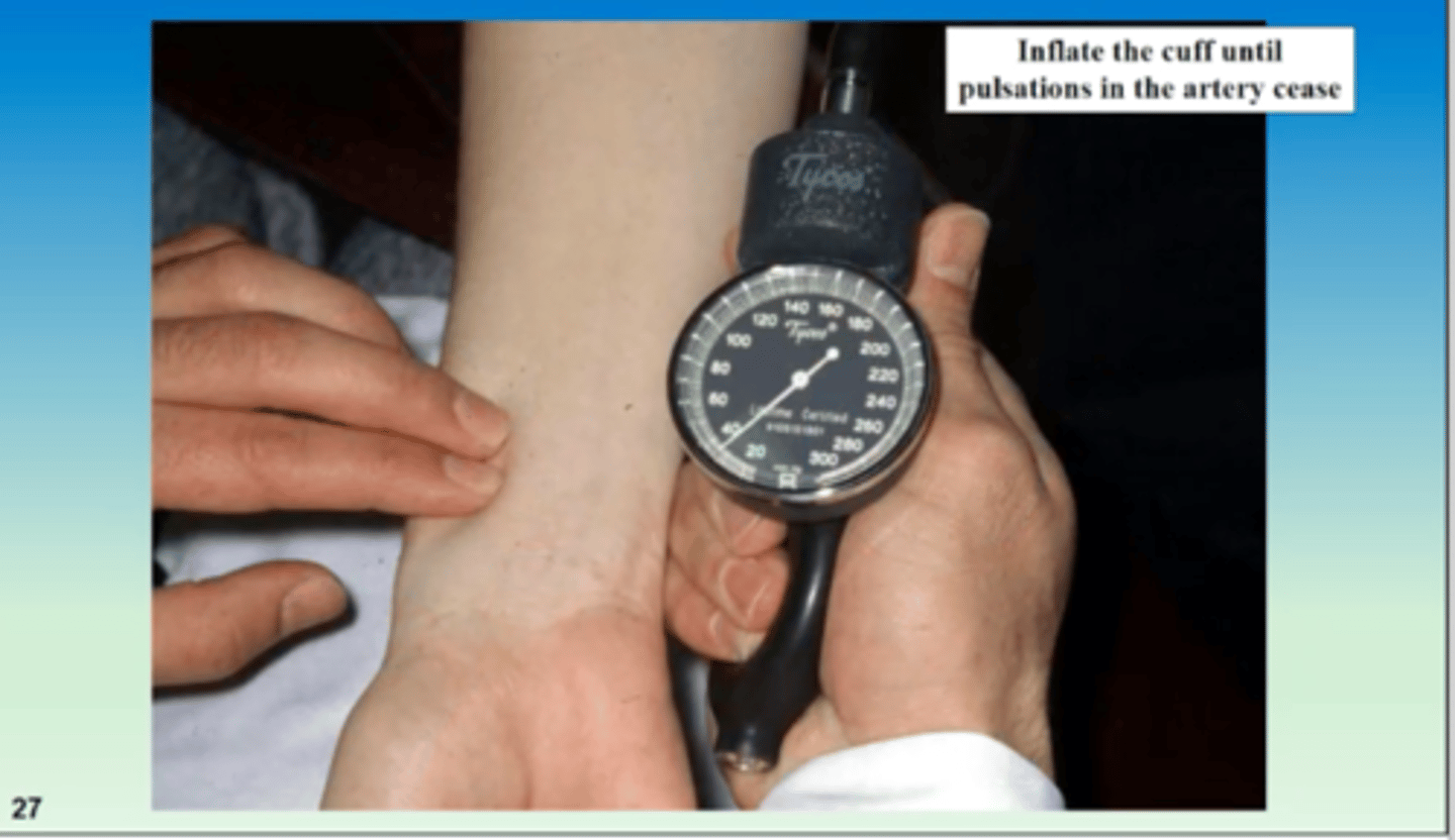 <p>feeling the radial pulse while the blood pressure cuff is deflating, used to determine systolic pressure</p>
