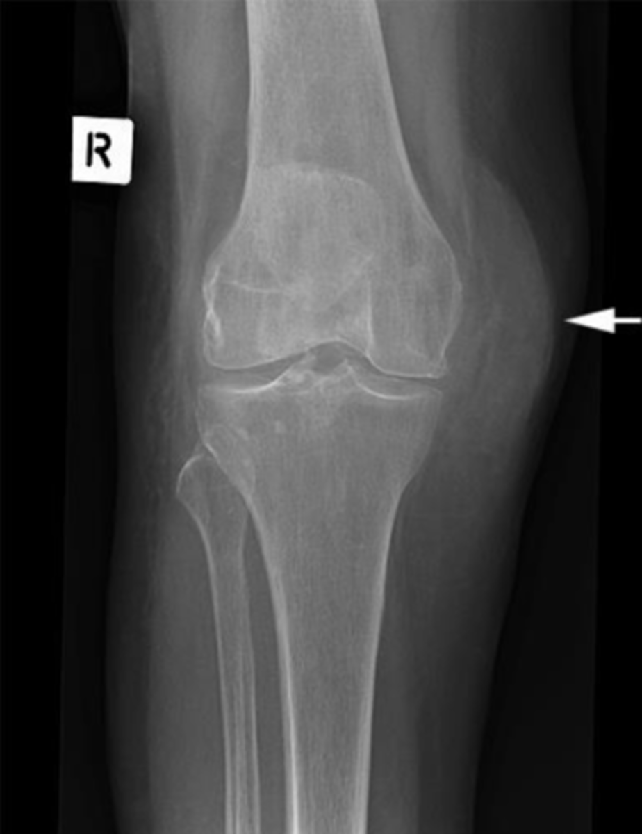 <p>What is the arrow pointing to?</p>