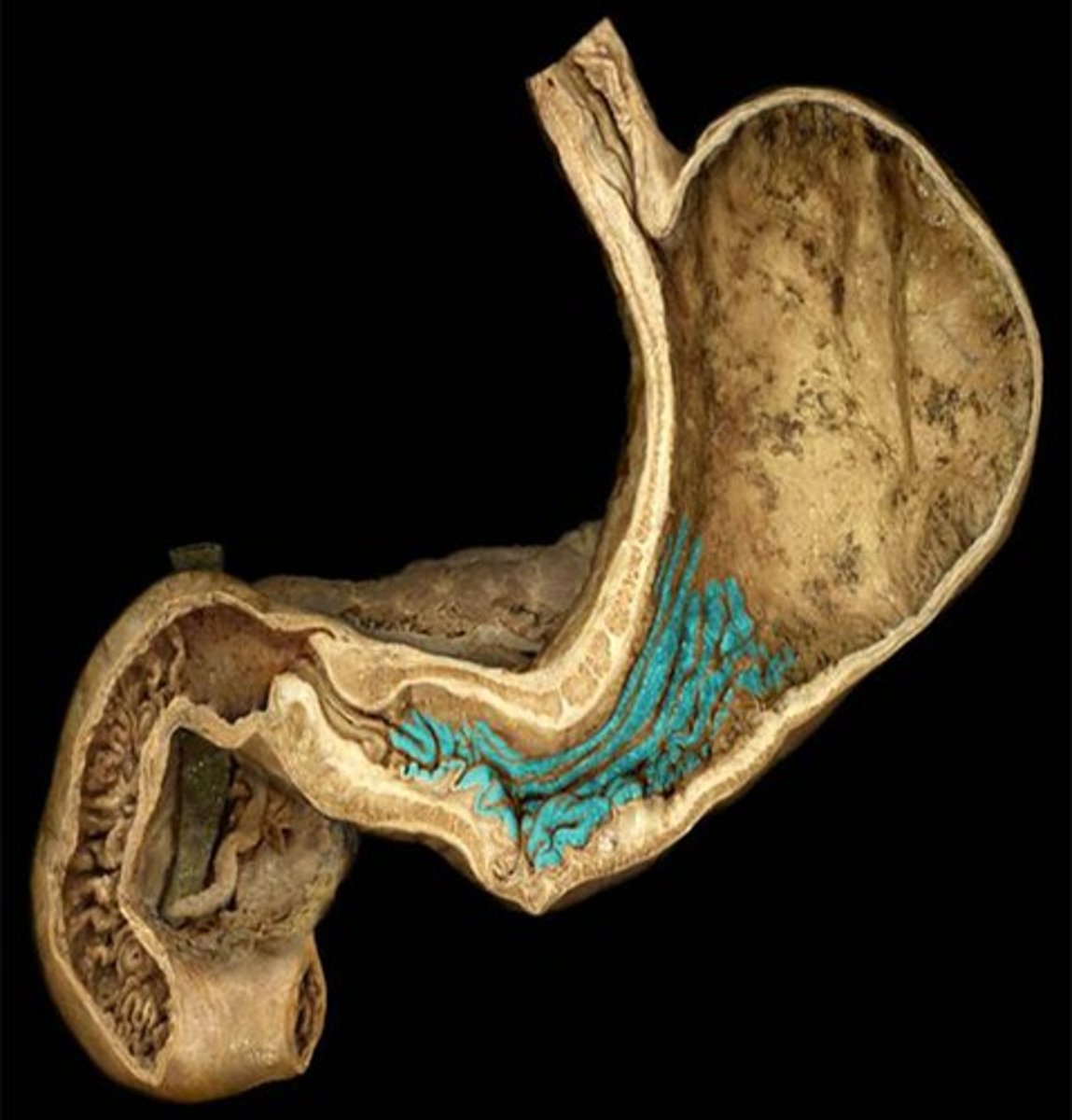 <p>Identify these structures.</p>