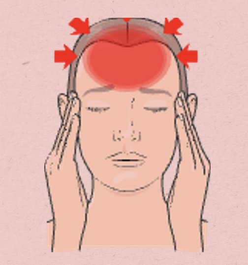 <p><span style="color: yellow"><strong>Background</strong></span>:</p><ul><li><p><span>Chronic, less severe</span></p></li><li><p><span>Very common</span></p></li><li><p><span>Stress → contraction of neck &amp; scalp muscles</span></p></li><li><p><span>Patho unclear</span></p></li><li><p><span>Possibly dilation of orbital &amp; adjacent extracranial arteries</span></p></li><li><p><span>Biopsy of artery to confirm</span></p></li></ul><p><span style="color: yellow"><strong>Clinical Manifestations</strong></span>: </p><ul><li><p><span>Constant, band-like pressure on forehead, temple, and/or back of neck</span></p></li><li><p><span>“a weight on top of my head”</span></p></li></ul><p></p>
