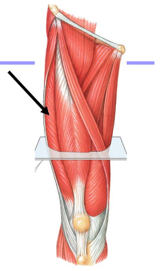 <p>Origin: Intertrochanteric Line and linea aspera of femur</p><p>Insertion: Tibial tuberosity</p><p>Action: Extends tibia</p>