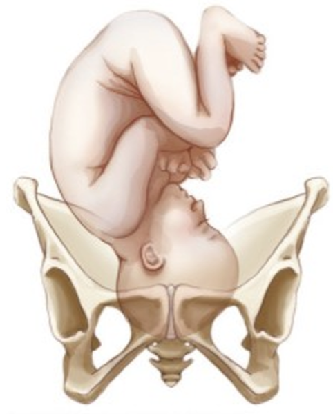 <ul><li><p>relation of fetal body parts to one another</p></li><li><p>posture of fetus to conform to uterine cavity</p></li><li><p><strong>normal- general flexion</strong></p><ul><li><p>head flexed, chin on chest</p></li><li><p>arms crossed over chest</p></li><li><p>legs flexed at knee, thighs on abdomen</p></li></ul></li><li><p><strong>abnormal- extension</strong></p></li></ul>