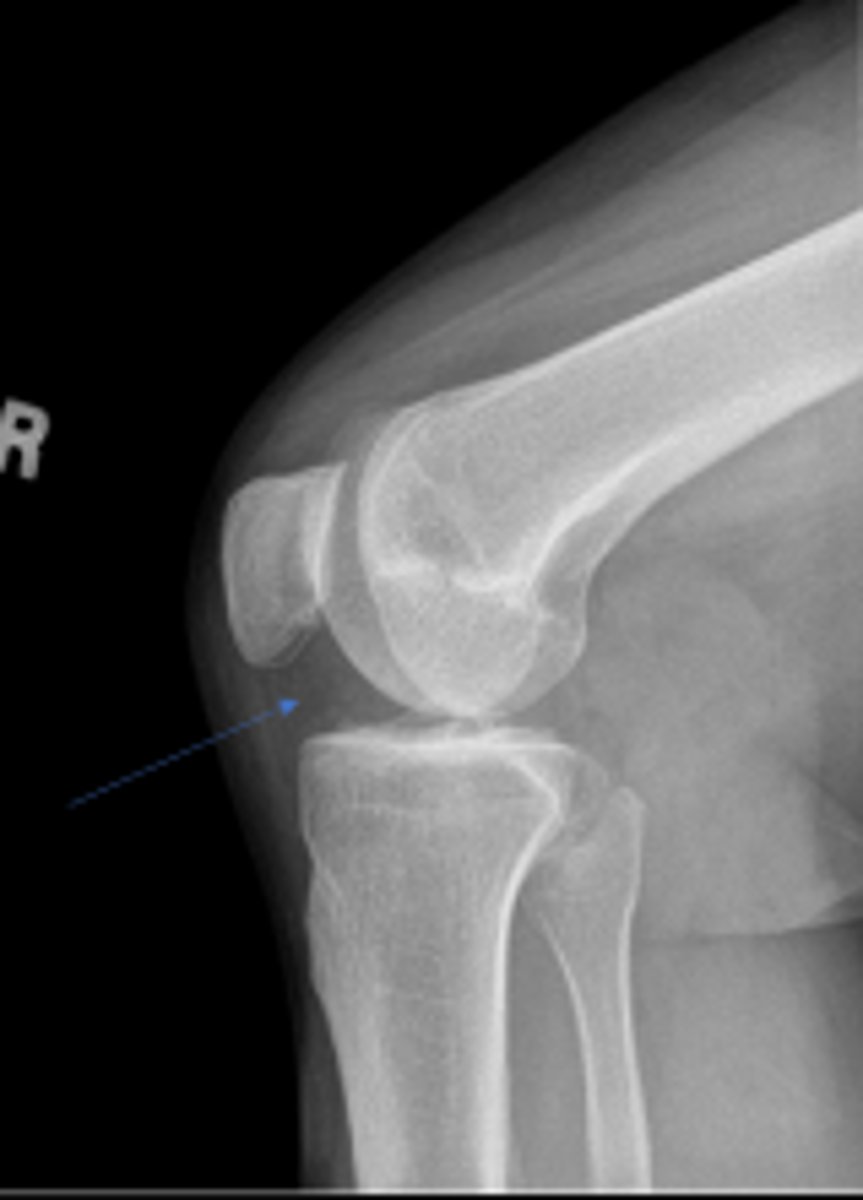 <p>What is outlined?</p>