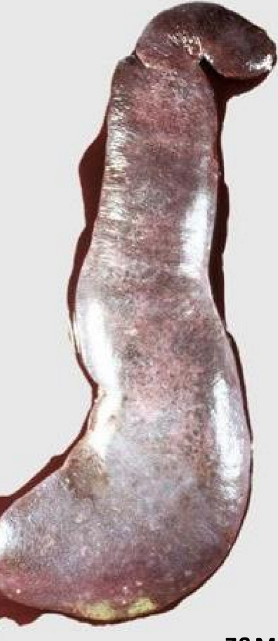 <p>What is this, and what are some differential diagnoses</p>