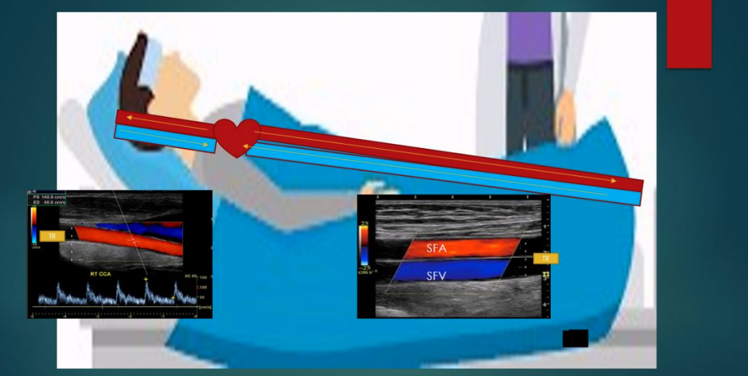 <p>describe the blood flow occurring in this image</p>