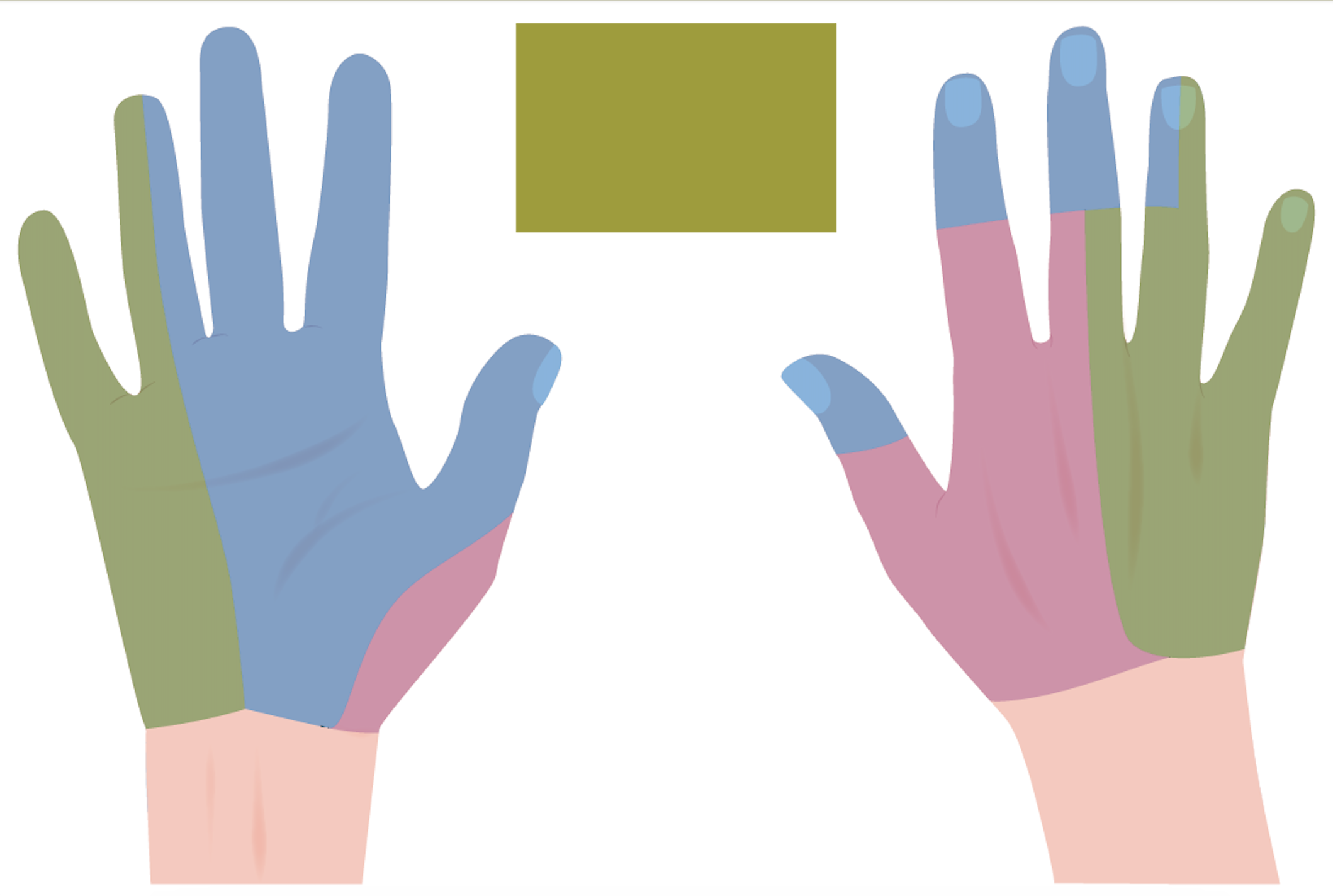 <p>Determine the Cutaneous innervation of the Hand. (Options: Ulnar Nerve, Median Nerve &amp; Radial Nerve) </p>