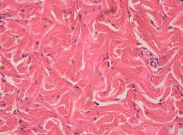 <p>Contains densely packed collagen fibers running in random directions with little open space in between </p>