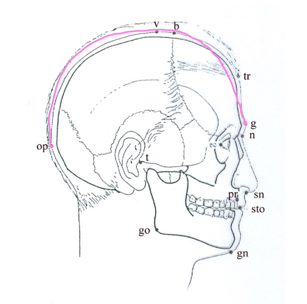 <p>glabella-opistokarion (g-op)</p>