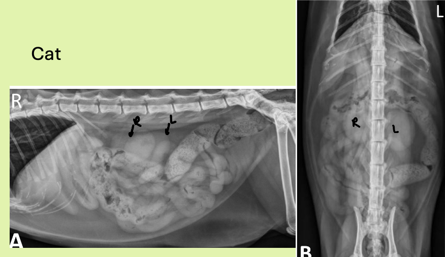 <p>more cd (same thing with right kidney more cr.)</p>