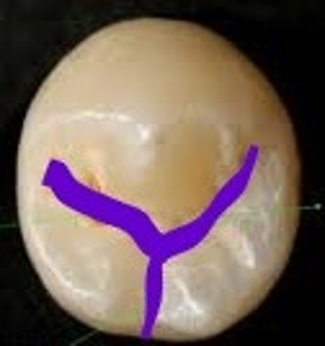 <p>Mandibular second premolar</p>