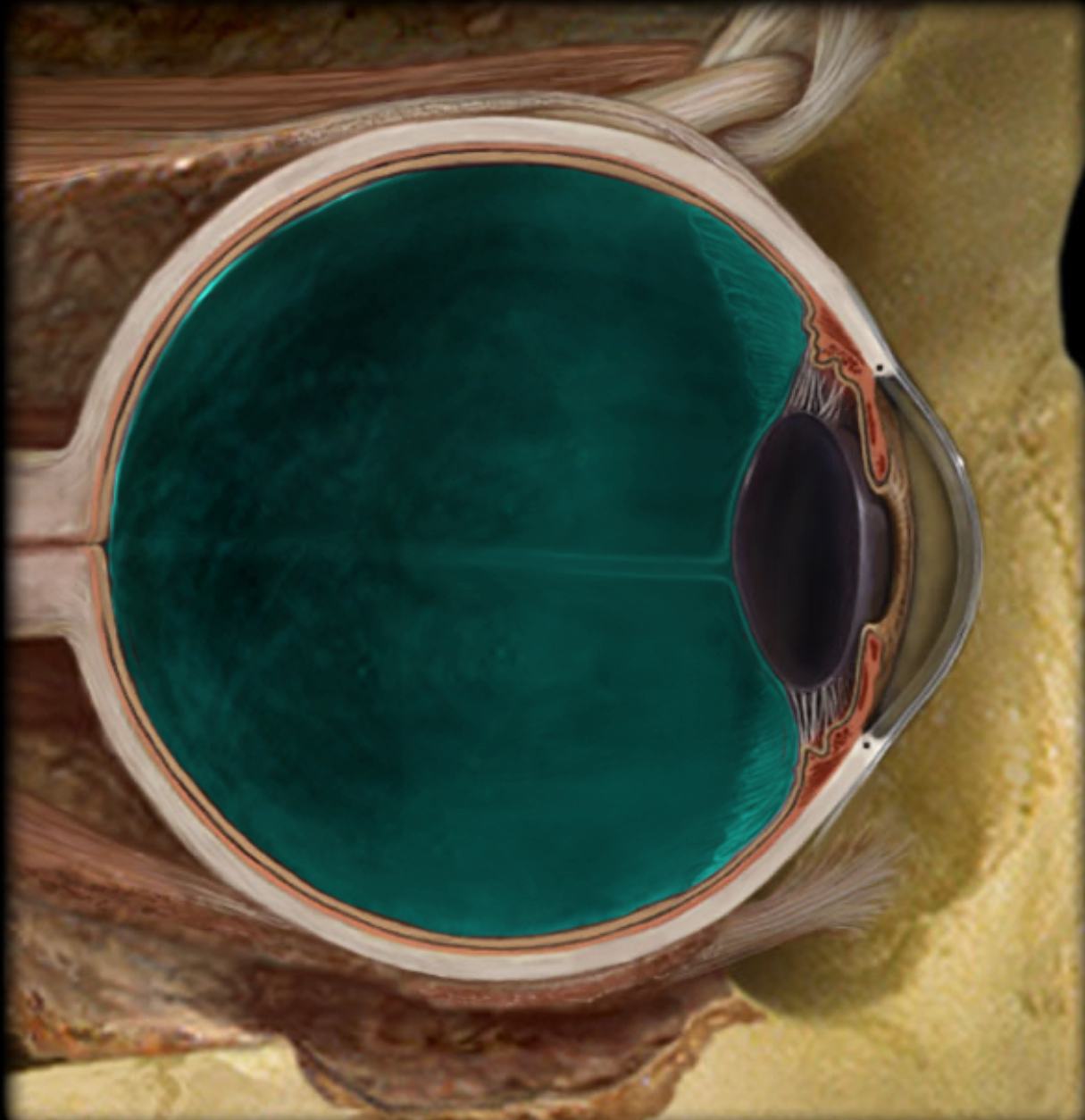 <h4 collapsed="false" seolevelmigrated="true"><strong>Location:</strong></h4><ul><li><p>Eye</p></li><li><p>Posterior to lens and its suspensory ligaments</p></li></ul><h4 collapsed="false" seolevelmigrated="true"><strong>Description:</strong></h4><ul><li><p>Cavity in eye</p></li><li><p>Occupied by vitreous body (humor)</p></li></ul><h4 collapsed="false" seolevelmigrated="true"><strong>Function:</strong></h4><ul><li><p>Maintain normal intraocular pressure and shape of the eye</p></li><li><p>Maintain lens and retina in place</p></li><li><p>Refraction of light</p></li></ul><h4 collapsed="false" seolevelmigrated="true"><strong>Also known as:</strong></h4><ul><li><p>Vitreous chamber</p></li></ul>