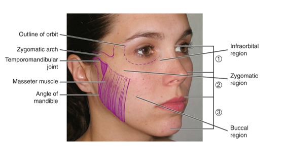 <ul><li><p>overlies the bony support for the cheek, the zygomatic arch</p></li><li><p>extends from just below (inferior) lateral margin of the eye toward the middle part of the external ear</p></li></ul><p></p>