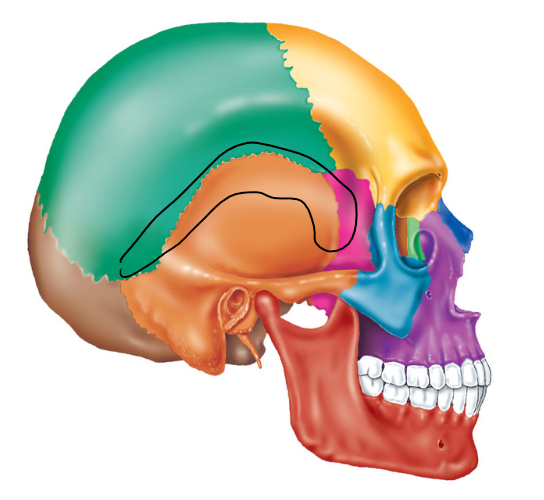 term image