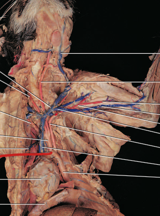 <p>carries oxygenated blood to the head, neck and upper extremities</p>