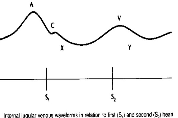<p>A</p>