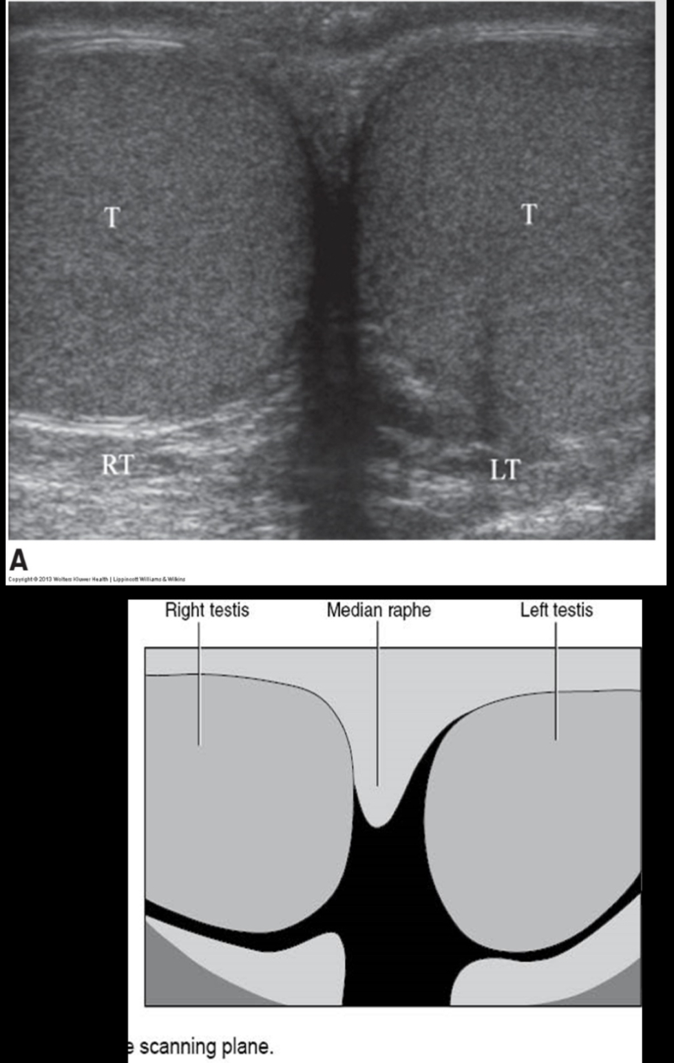 <p>What is the average adult size of testis?</p>