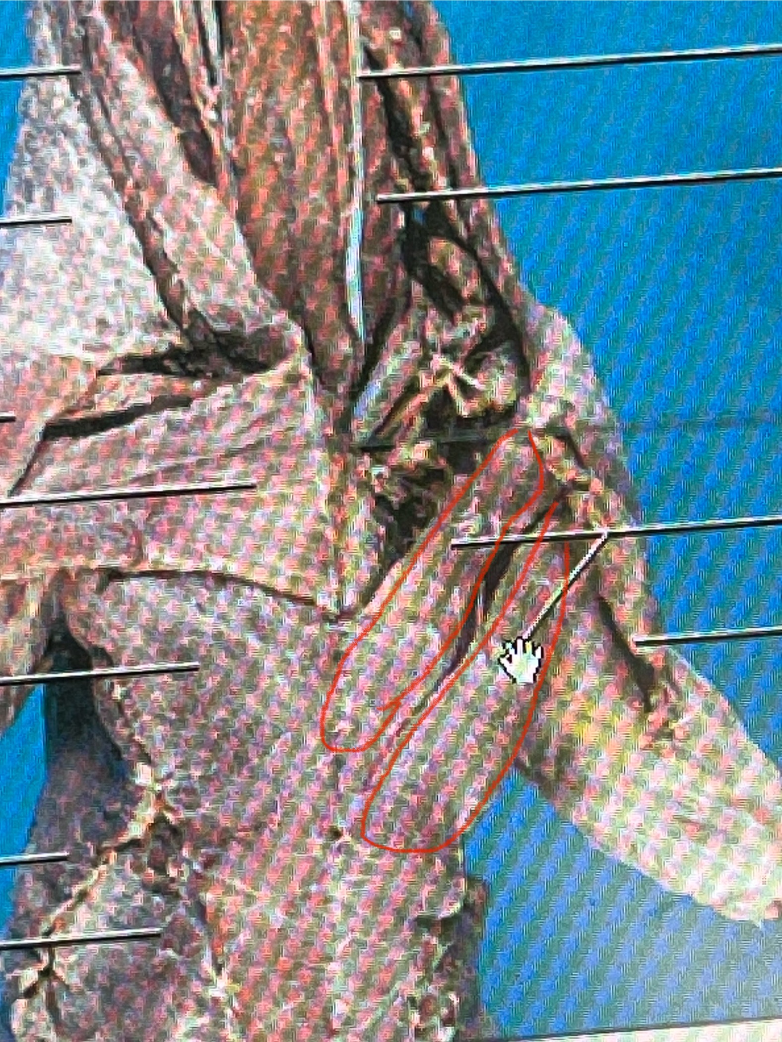 <p>Pectoralis Minor</p>