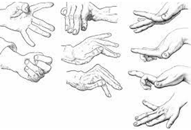 <p>What is <strong>athetosis?</strong></p>