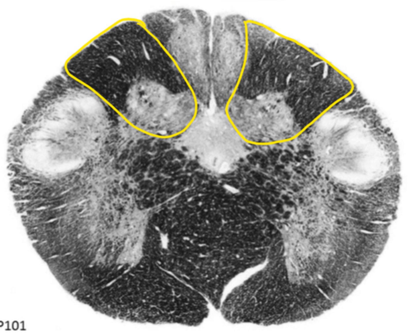 <p>ID the dark area</p>